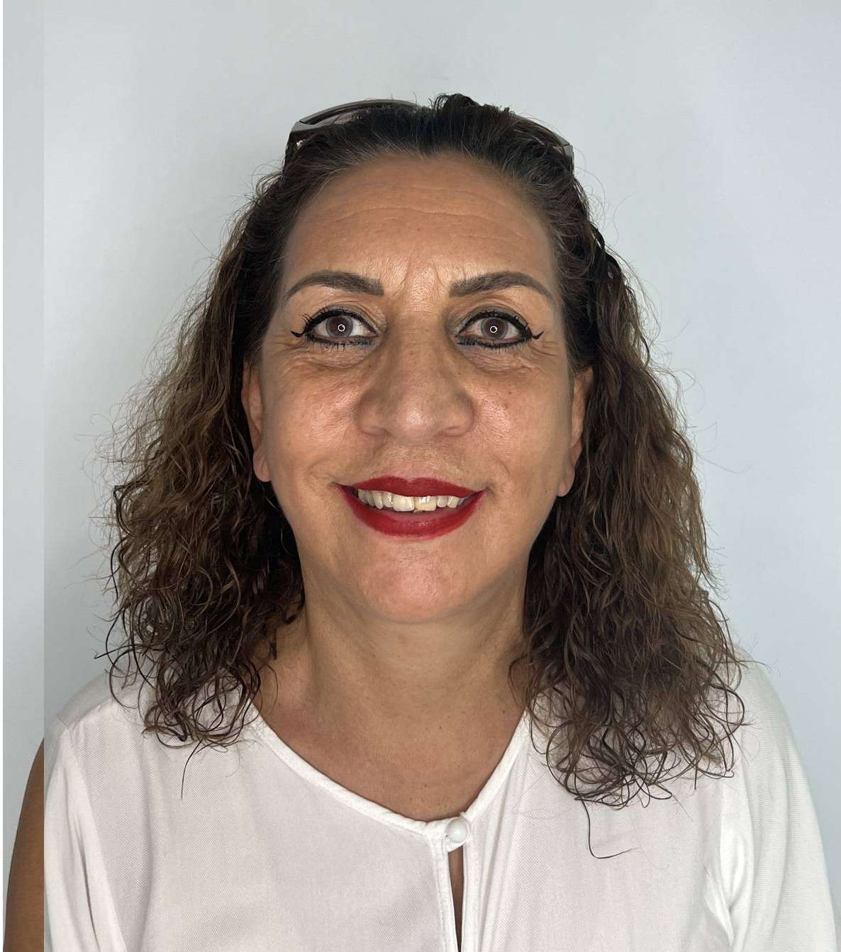 Ritidoplastia o lifting facial – antes del procedimiento | Dr. Alejandro Lozano, cirujano plástico en Neiva